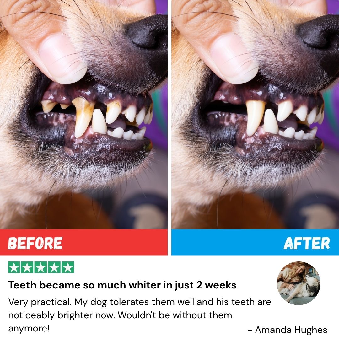 FreshWipes Kit – Protects Against Dental Diseases