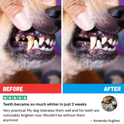 FreshWipes Kit – Protects Against Dental Diseases