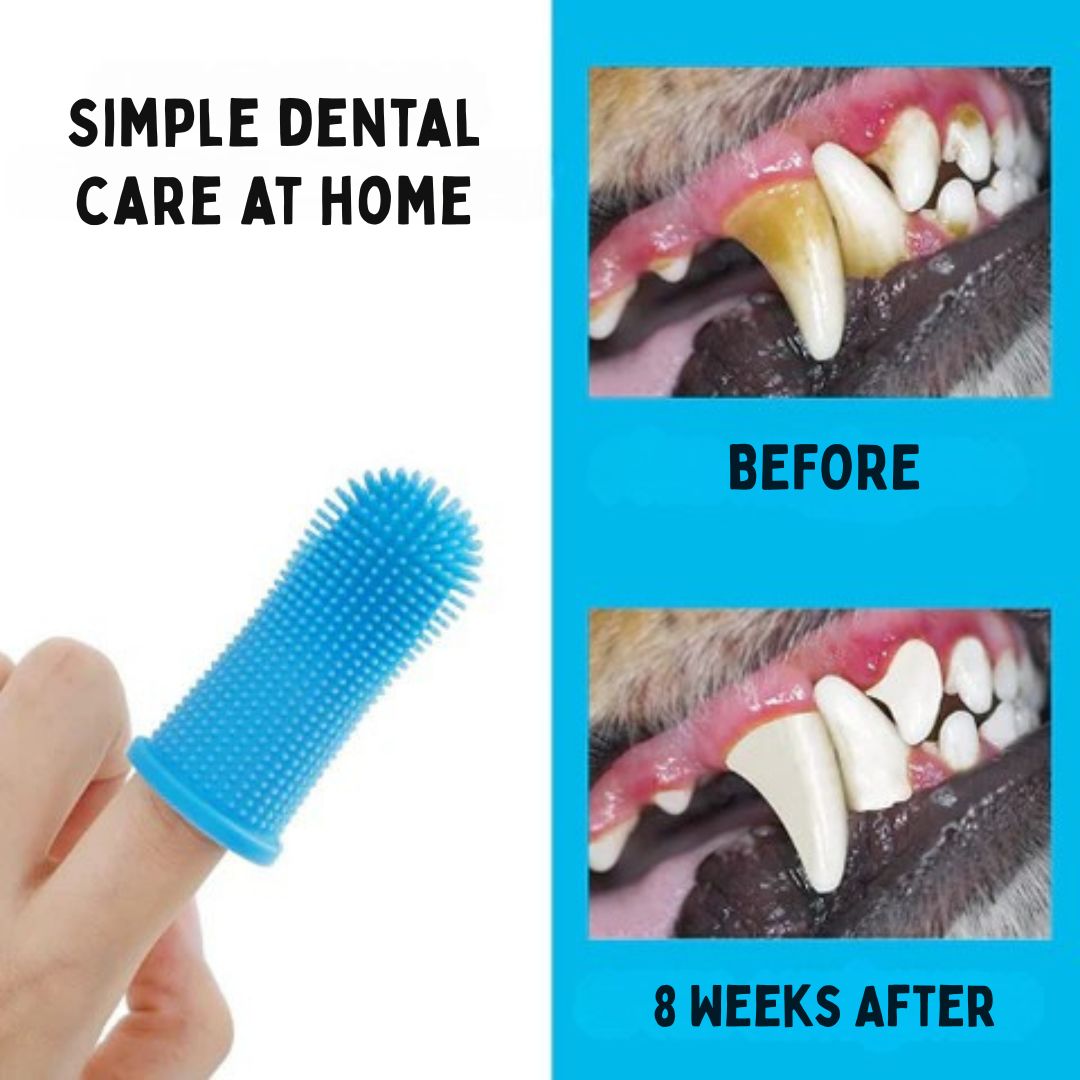 Finger Brush – Soft & Gentle Finger Toothbrush