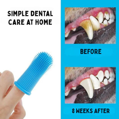 Finger Brush – Soft & Gentle Finger Toothbrush